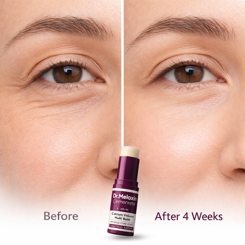 LEVIO GCHARL PUSS GROWER